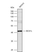 Solarbio K112247P Anti-BCS1L Polyclonal Antibody