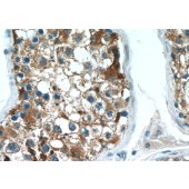 Solarbio K009776P Anti-ACRV1 Polyclonal Antibody