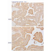 Solarbio K110291P Anti-RAB2A Polyclonal Antibody