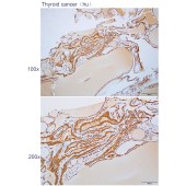 Solarbio K112294P Anti-NOTCH2NL Polyclonal Antibody