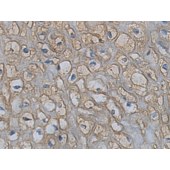 Solarbio K009848P Anti-KCNIP4 Polyclonal Antibody