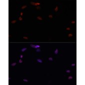 Solarbio K001766P Anti-PARP Polyclonal Antibody