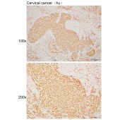 Solarbio K110517P Anti-SET Polyclonal Antibody