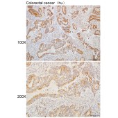 Solarbio K110312P Anti-ARFGAP1 Polyclonal Antibody