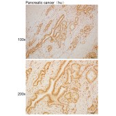 Solarbio K110473P Anti-NDUFV1 Polyclonal Antibody