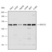 Solarbio K110343P Anti-ERCC5 Polyclonal Antibody