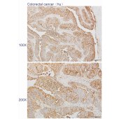 Solarbio K110520P Anti-RNF8 Polyclonal Antibody