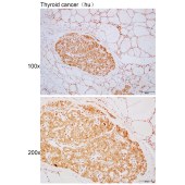 Solarbio K110375P Anti-ZNF461 Polyclonal Antibody