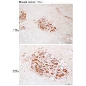 Solarbio K112159P Anti-PLCG1 Polyclonal Antibody