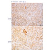 Solarbio K110479P Anti-THUMPD3 Polyclonal Antibody