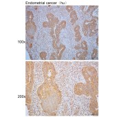 Solarbio K110401P Anti-NCAPD2 Polyclonal Antibody
