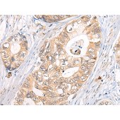 Solarbio K009831P Anti-CLPTM1 Polyclonal Antibody