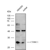 Solarbio K112244P Anti-CTHRC1 Polyclonal Antibody