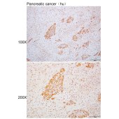 Solarbio K110346P Anti-GNA15 Polyclonal Antibody