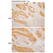Solarbio K110036P Anti-GPRC5C Polyclonal Antibody