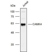 Solarbio K110087P Anti-CAMK4 Polyclonal Antibody