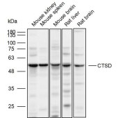 Solarbio K110121P Anti-CTSD Polyclonal Antibody