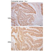 Solarbio K110463P Anti-EPHB4 Polyclonal Antibody