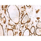 Solarbio K009835P Anti-GRWD1 Polyclonal Antibody