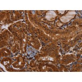 Solarbio K009800P Anti-WDR83 Polyclonal Antibody