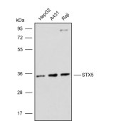 Solarbio K009834P Anti-STX5 Polyclonal Antibody