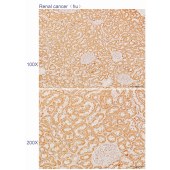Solarbio K110298P Anti-TNFAIP6 Polyclonal Antibody