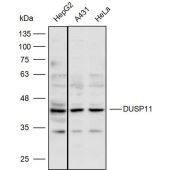 Solarbio K110360P Anti-DUSP11 Polyclonal Antibody