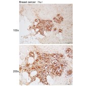 Solarbio K112162P Anti-ADGRF5 Polyclonal Antibody