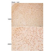 Solarbio K112205P Anti-GRIN2B Polyclonal Antibody