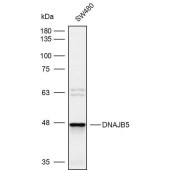 Solarbio K109934P Anti-DNAJB5 Polyclonal Antibody
