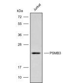 Solarbio K009840P Anti-PSMB3 Polyclonal Antibody