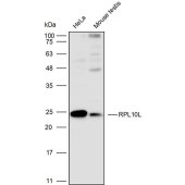 Solarbio K110356P Anti-RPL10L Polyclonal Antibody