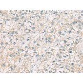 Solarbio K009828P Anti-CHMP6 Polyclonal Antibody