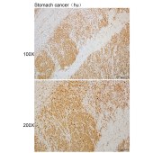 Solarbio K110333P Anti-VAPB Polyclonal Antibody
