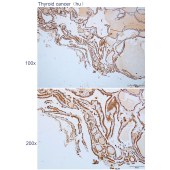 Solarbio K112221P Anti-ANKRD45 Polyclonal Antibody
