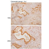 Solarbio K109998P Anti-KBTBD4 Polyclonal Antibody