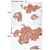 Solarbio K112282P Anti-RBPMS Polyclonal Antibody