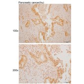 Solarbio K110042P Anti-SP100 Polyclonal Antibody