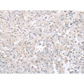Solarbio K009838P Anti-FXYD6 Polyclonal Antibody