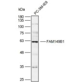 Solarbio K110074P Anti-FAM149B1 Polyclonal Antibody