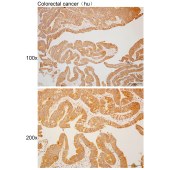 Solarbio K110459P Anti-CNOT2 Polyclonal Antibody