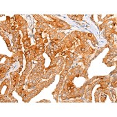 Solarbio K009829P Anti-CHRD Polyclonal Antibody