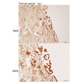 Solarbio K112197P Anti-MYOM1 Polyclonal Antibody
