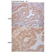 Solarbio K110329P Anti-GBA3 Polyclonal Antibody