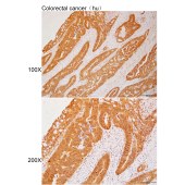 Solarbio K112204P Anti-POLA1 Polyclonal Antibody