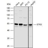 Solarbio K110045P Anti-STK3 Polyclonal Antibody