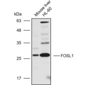 Solarbio K110273P Anti-FOSL1 Polyclonal Antibody