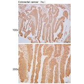 Solarbio K110370P Anti-PLIN2 Polyclonal Antibody