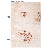 Solarbio K112189P Anti-MAGI2 Polyclonal Antibody