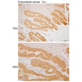 Solarbio K110039P Anti-PGAP4 Polyclonal Antibody